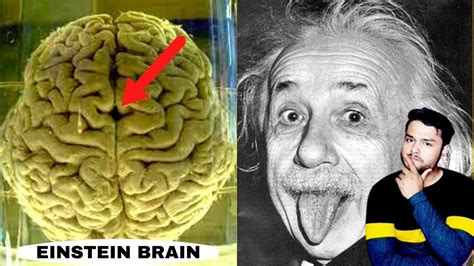 How Einstein Brain Is Different From Others Strange Facts About