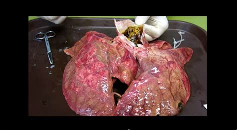 When you smoke, your risk of death from copd is 10 times greater than if you did not smoke. Effects Of Smoking: Scientists Demonstrate The Incredible ...