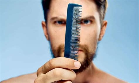 6 Causes Of Beard Hair Loss And Solutions