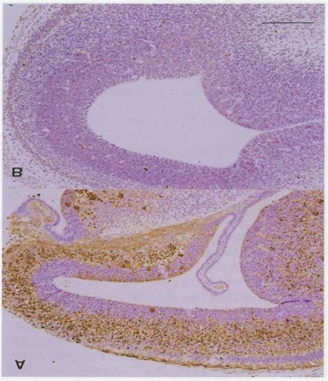 Abundant Tunel Labeled Cells Are Seen In The Irradiated E15 Cerebral