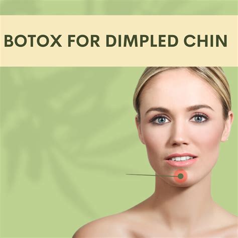 Botox For Dimpled Chin Elegance Podcast