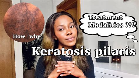 Keratosis Pilaris On Black Skin How Why And Best Treatment Plans