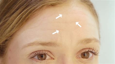 How To Tell If Your Skin Is Thinning And How To Fix It Youtube