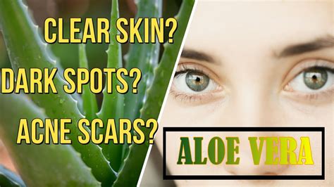 Build Your Confidence Have Clear Skin Try Aloe Vera To Remove Dark