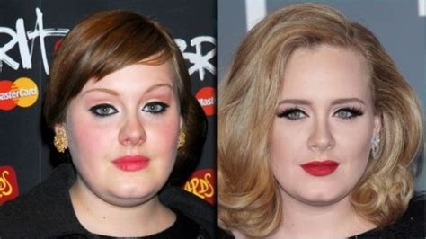 Adele Plastic Surgery Nose Job Before And After Star Plastic Surgery
