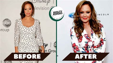 Has Leah Remini Had Plastic Surgery Before And After Photos