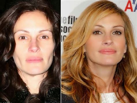 Julia Roberts Plastic Surgery Nose Job Facelift And Eyelid Before And