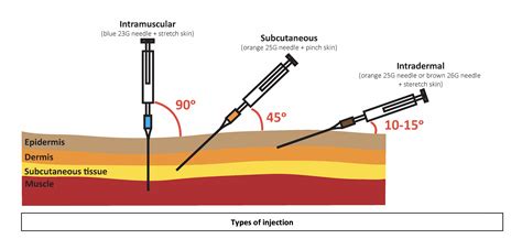 Intramuscular Injection Oscestop Osce Learning