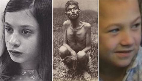9 Tragic Cases Of Feral Children Who Were Found In The Wild