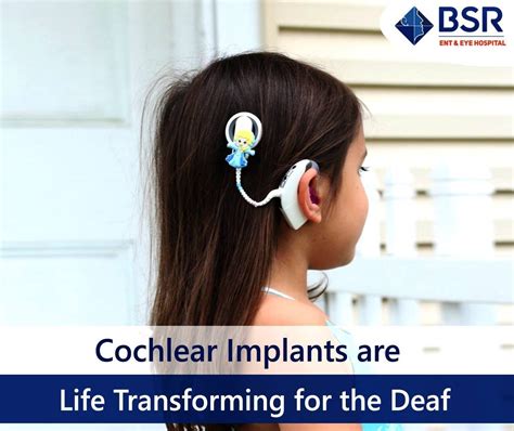 Cochlear Implant Surgery Cost Procedure Risks Hearing Aids In Hyderabad