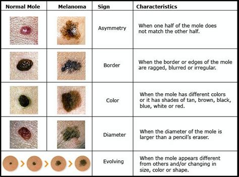 What Does Early Stage Skin Cancer Look Like