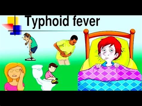 Typhoid Fever Pathogenesis Vectors Bacteria Symptoms Diagnosis