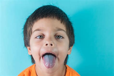 Tongue Signs Of Health Problems What Do Different Tongue Colors Indicate