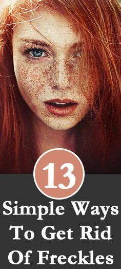 12 home remedies to get rid of freckle on face getting rid of freckles freckles spots on face