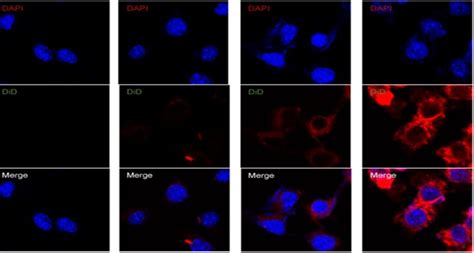 Exosomes Derived From Natural Killer Cells Exert Therapeutic Effect In