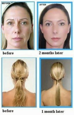 Argan oil on the other hand enriches your hair as it nourishes it with nutrients and thus repairing damage. Argan Oil Before and After Photos | Argan oil before and ...