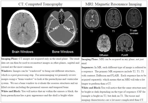 Ct Vs Mri How Can You Tell The Difference Faculty Of Medicine