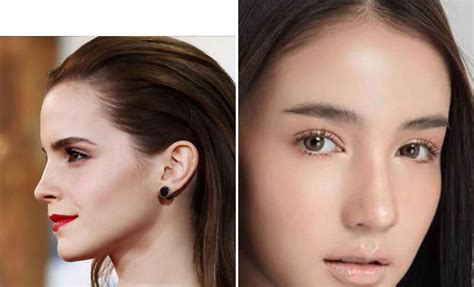 Female Vertical Flat Forehead Shape Explore Plastic Surgery