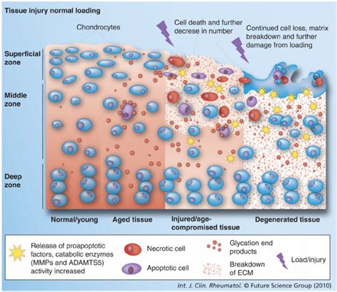 Cellular And Extracellular Matrix Changes Associated With Age That Lead