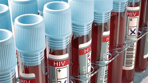 Could This Alcoholism Drug Cure Hiv