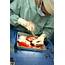 Kidney Transplant  Stock Image M575/0068 Science Photo Library