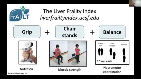 Frailty In Patients With Cirrhosis From Recognition To Reversal Presented By Jennifer Lai Md