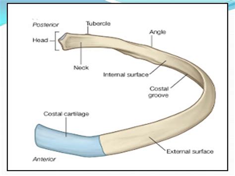 Typical Cervical Vertebrae Bone Diagram