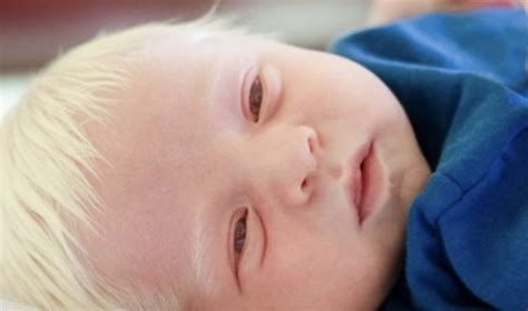 The Baby Who Was Born With Gray Hair Was A Real Star Of The Internet