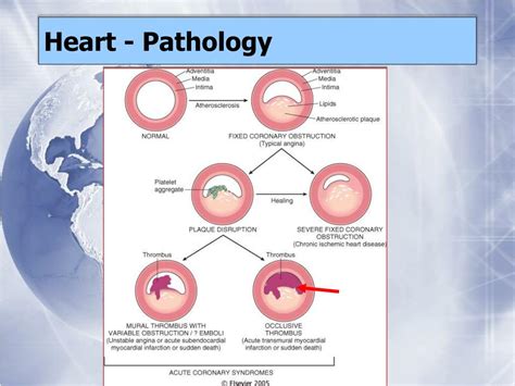 Ppt Heart Pathology Powerpoint Presentation Free Download Id6903883