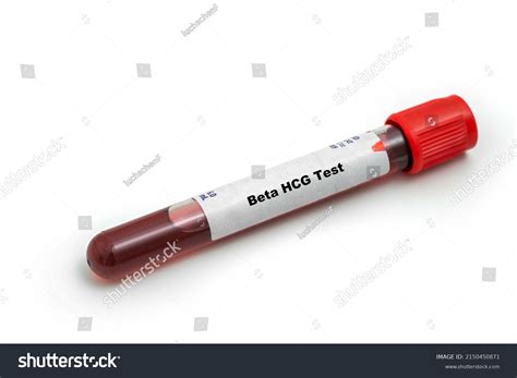 Beta Hcg Test Medical Check Test Stock Photo 2150450871 Shutterstock