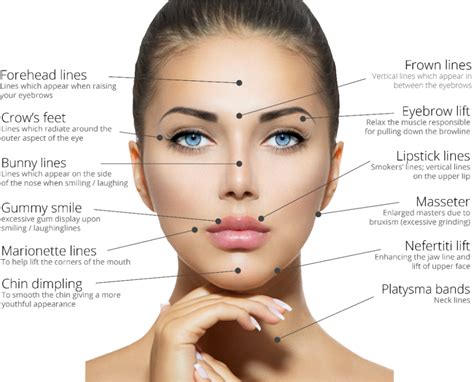 What Are Wrinkle Relaxing Injections — Uk