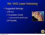 Laser Treatment For Eyes Advantages And Disadvantages Photos