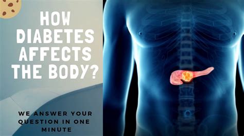 How Diabetes Affects The Body Youtube