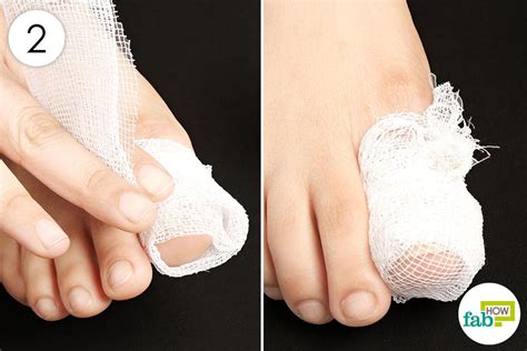 Is toenail removal covered by insurance. 10 Brilliant Health and Beauty Hacks of Vicks VapoRub ...