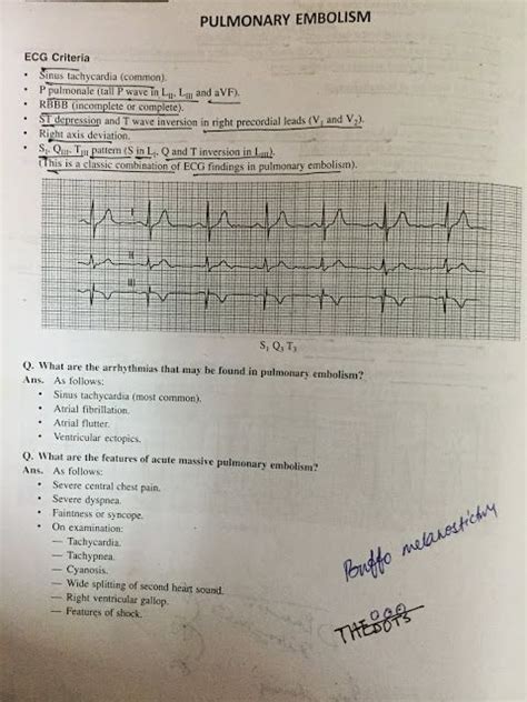 Medical School Ecg Pulmonary Embolismdextrocardiaand Emd