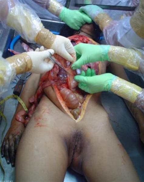FREE Girl Autopsy QPORNX