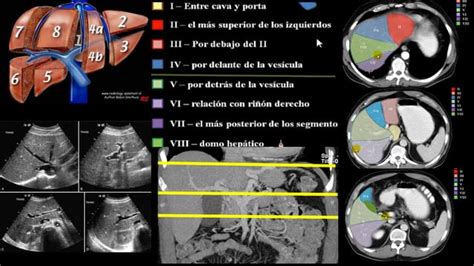 Imagenologia De Higado Y Vias Biliares Rx Ppt