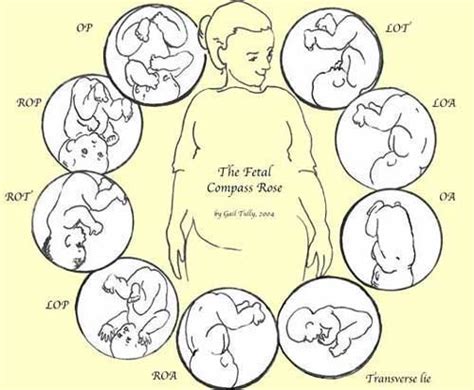 Achieve Optimal Fetal Positioning And Pelvic Tilt Demonstration The