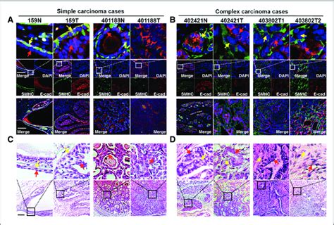 Myoepithelial Cell Proliferation Is Absent In Canine Simple Carcinomas