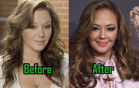 Leah Remini Plastic Surgery Facelift Lips Surgery Before After Leah Remini Lip Surgery
