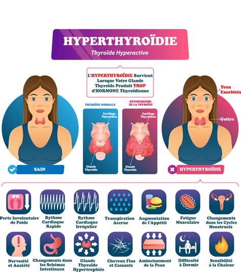 Hyperthyroïdie Symptômes Traitements Et Préventions Information