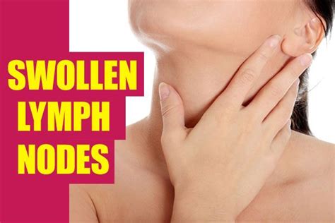 Home Remedies For Swollen Lymph Nodes Top 10 Home Remedies