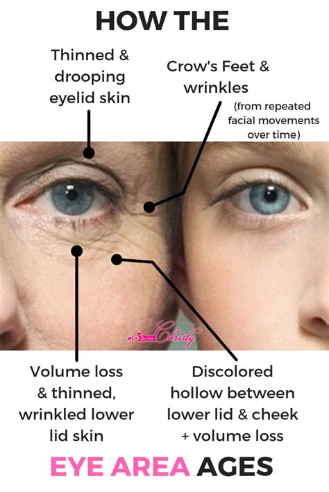 Anti Aging Wrinkles Around The Eyes Eyelid Wrinkles Face Wrinkles