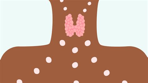 Doctors Guide To The Thyroid Stimulating Hormone Tsh Livi Uk