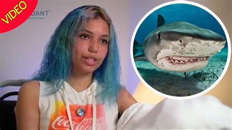 Shark Attack Victim 17 Who Lost Leg And Several Fingers Leaves