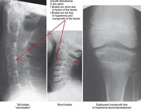 Arthritis Radiology Key