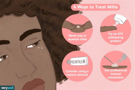Milia Removal Safe Ways To Get Rid Of White Face Bumps