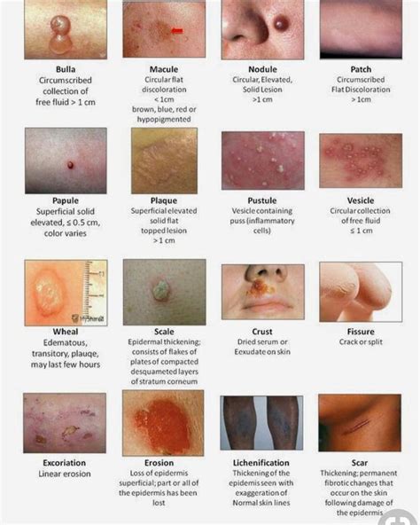 Dermatology Skin Terminology Physician Assistantmedical Student