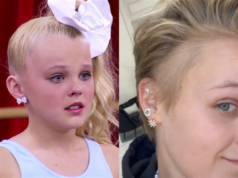 Jojo Siwa Says Bald Patch Is From Dance Moms Stress Not Ponytails
