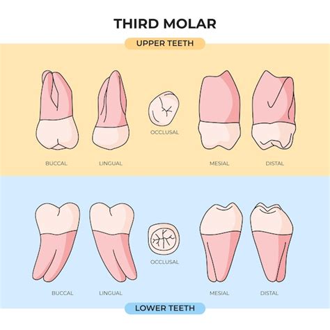 Vista Anatómica De Los Dientes Superiores E Inferiores Del Tercer Molar